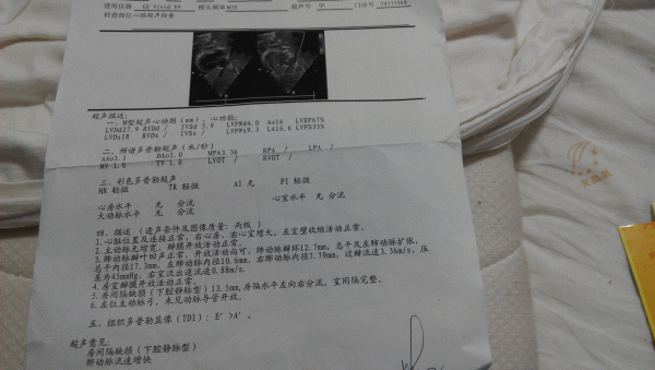 心脏彩超