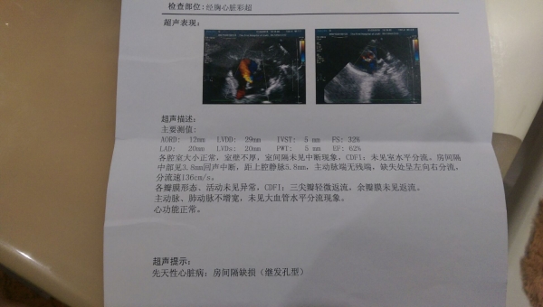 彩超.jpg