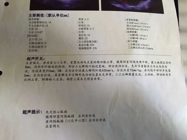 1413182292_旋转.jpg