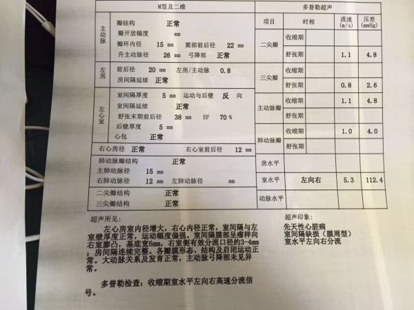 1832913819_旋转.jpg