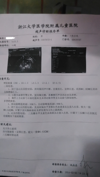 7个月23天的B超