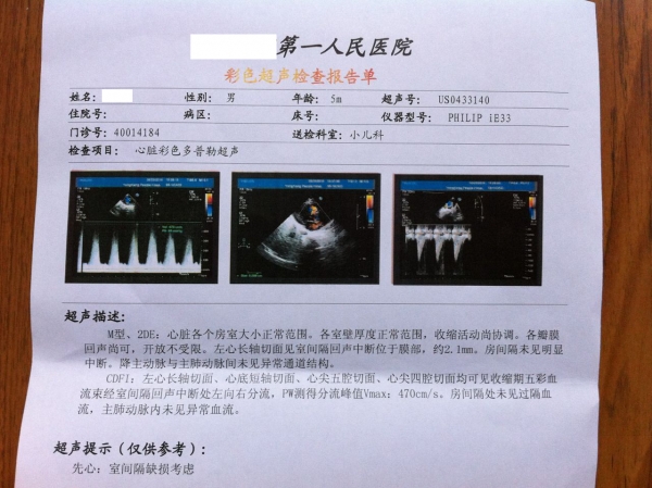 2015年8月20日彩超