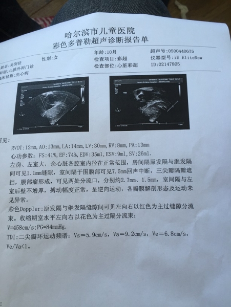 心超单