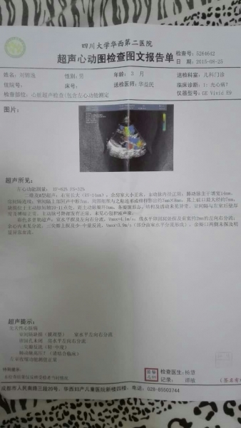 心脏彩超报告单.jpg