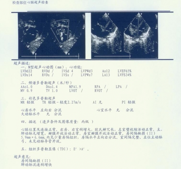 彩超报告