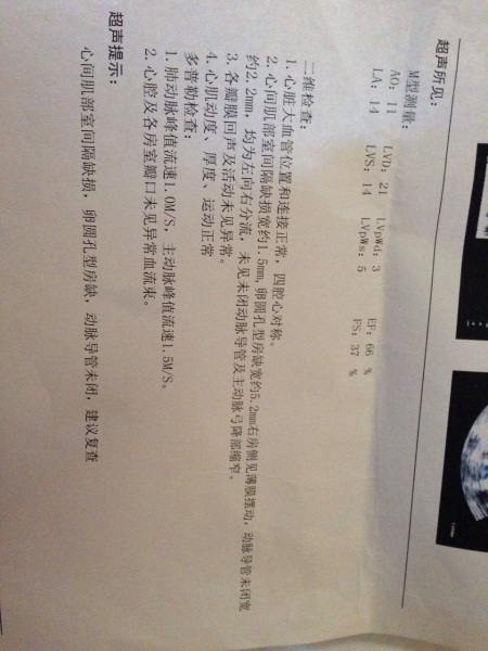 心超2.jpg