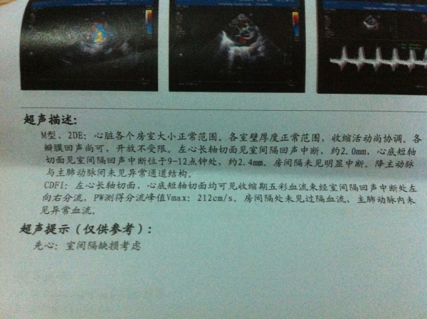 宝宝2个月时查的