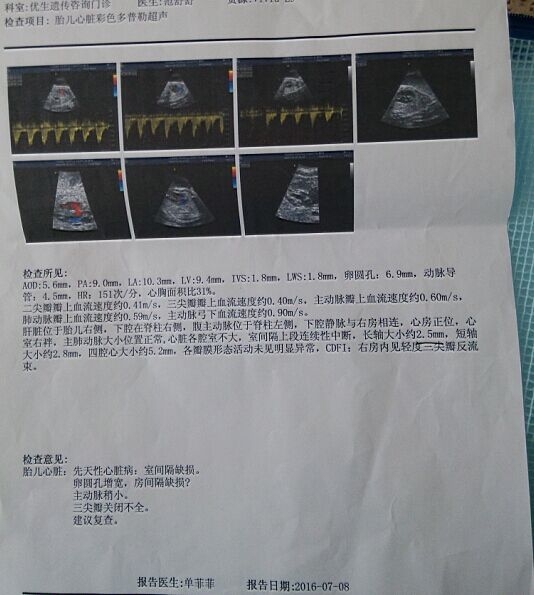 彩超单
